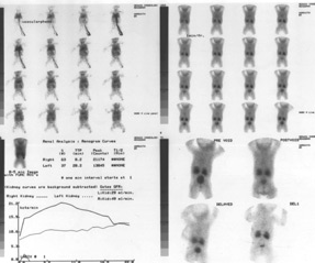 Pediatric Urology in hyderabad